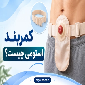 کمربند استومی چیست؟