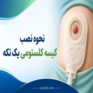 نحوه نصب کیسه کلستومی یک تکه