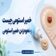 خمیر استومی چیست و نحوه زدن خمیر استومی؟