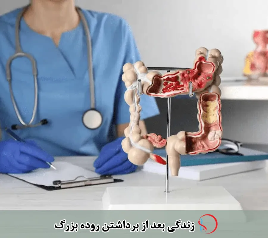 زندگی بعد از برداشتن روده بزرگ