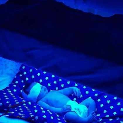 اجاره دستگاه زردی کرمانشاه