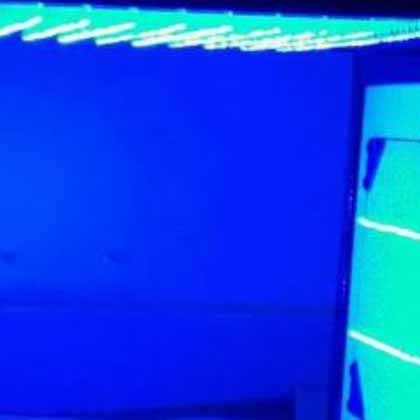 اجاره دستگاه فتوتراپی در اهواز