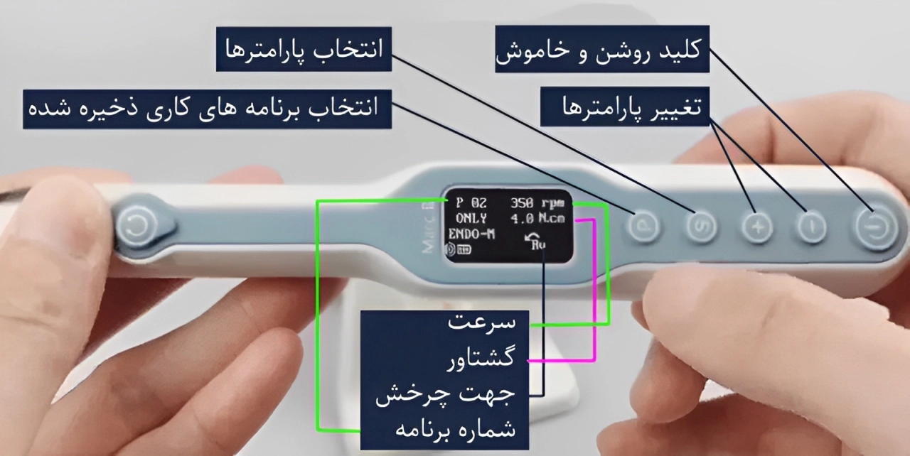 اندو موتور چیست 