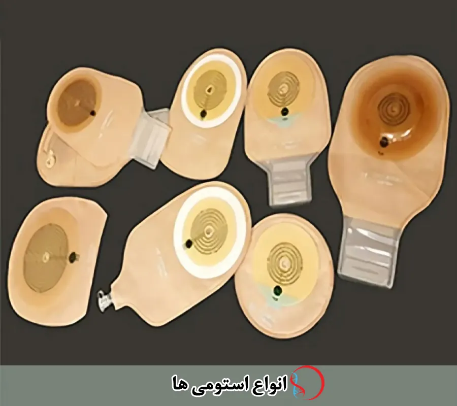 انواع استومی ها