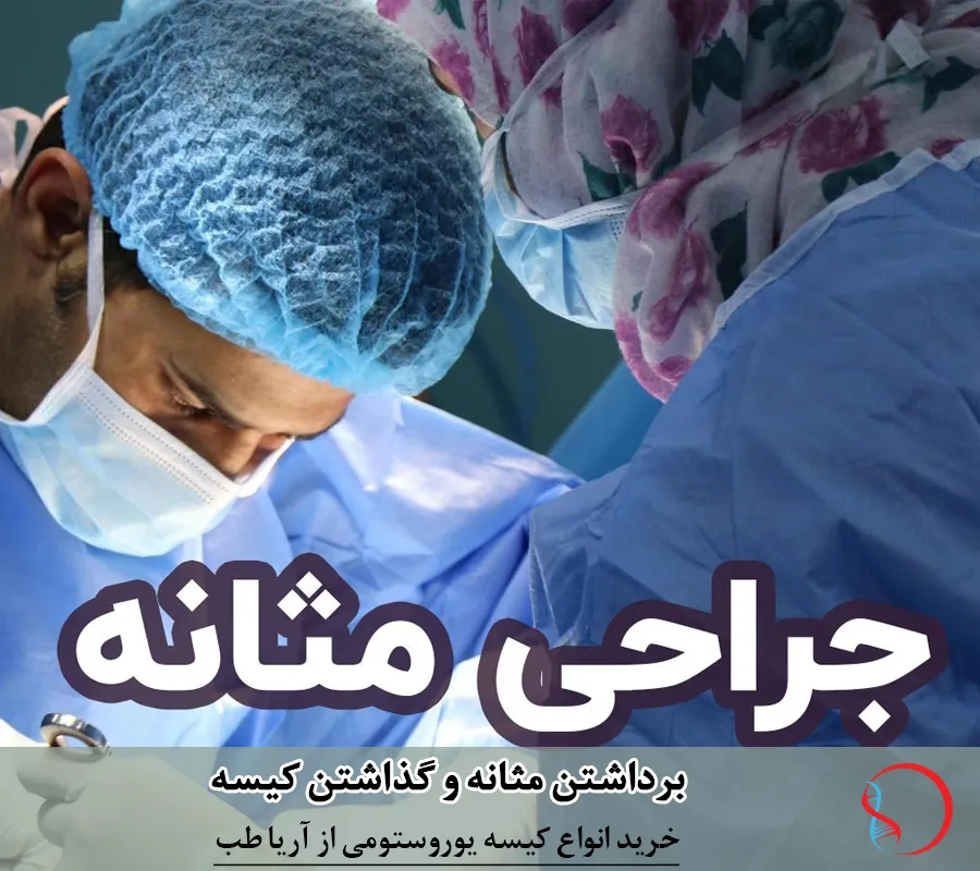 زندگی بعد از برداشتن مثانه