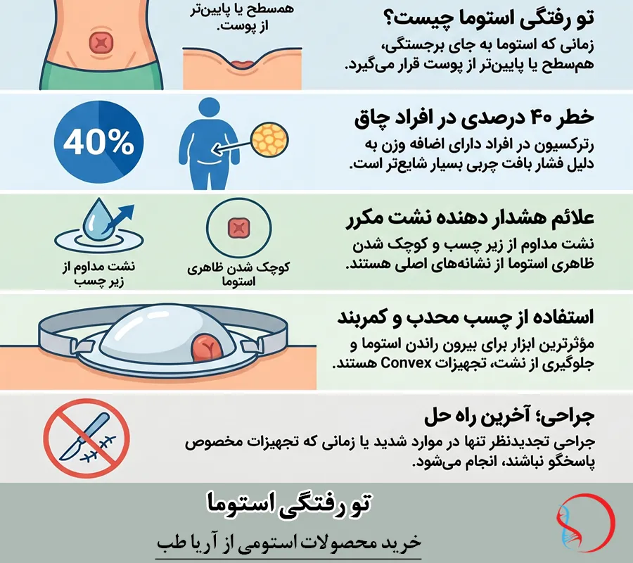 تو رفتگی استومی
