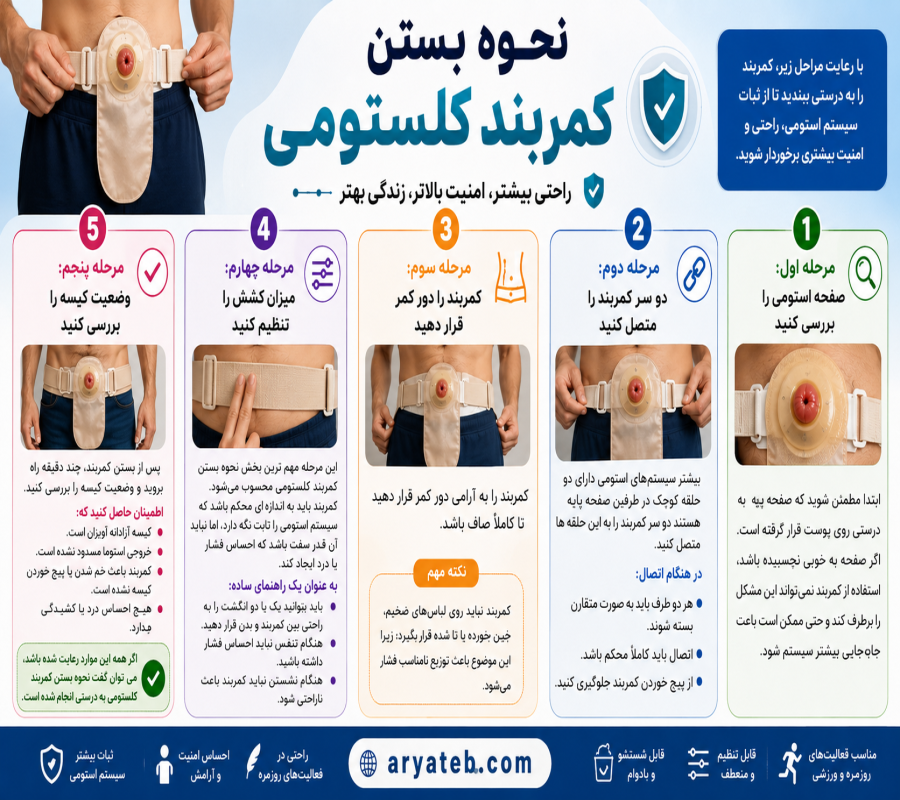 نحوه بستن کمربند کلستومی