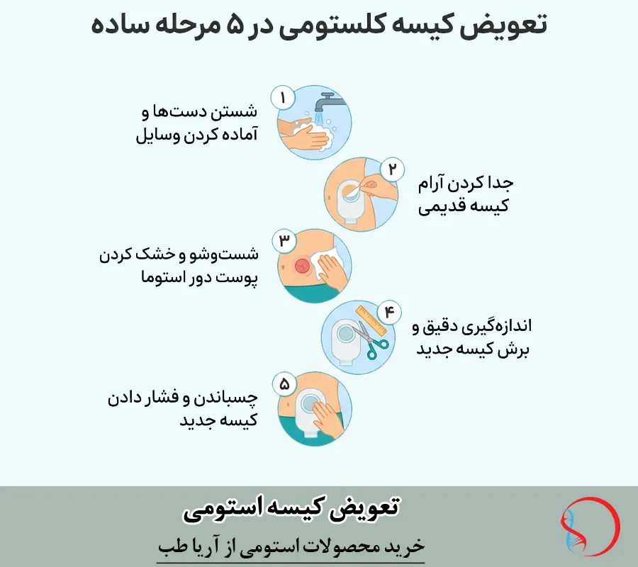 مراحل تعویض کیسه کلستومی در 5 مرحله