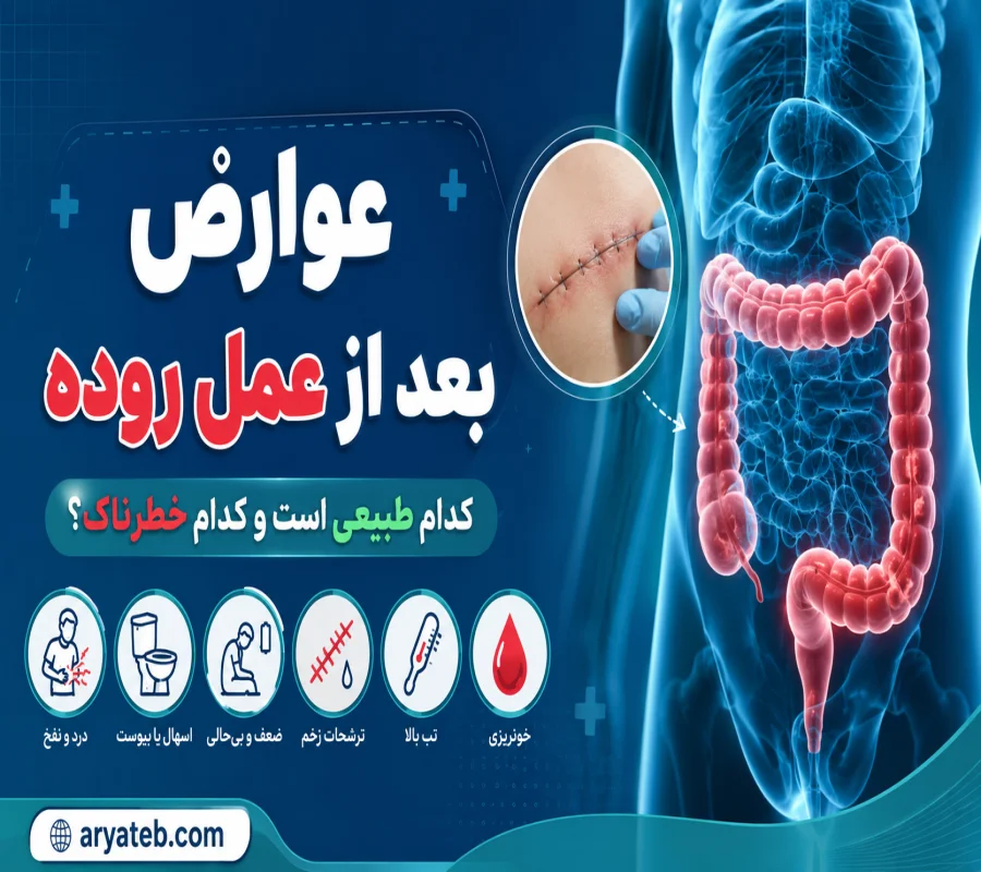 عمل روده3
