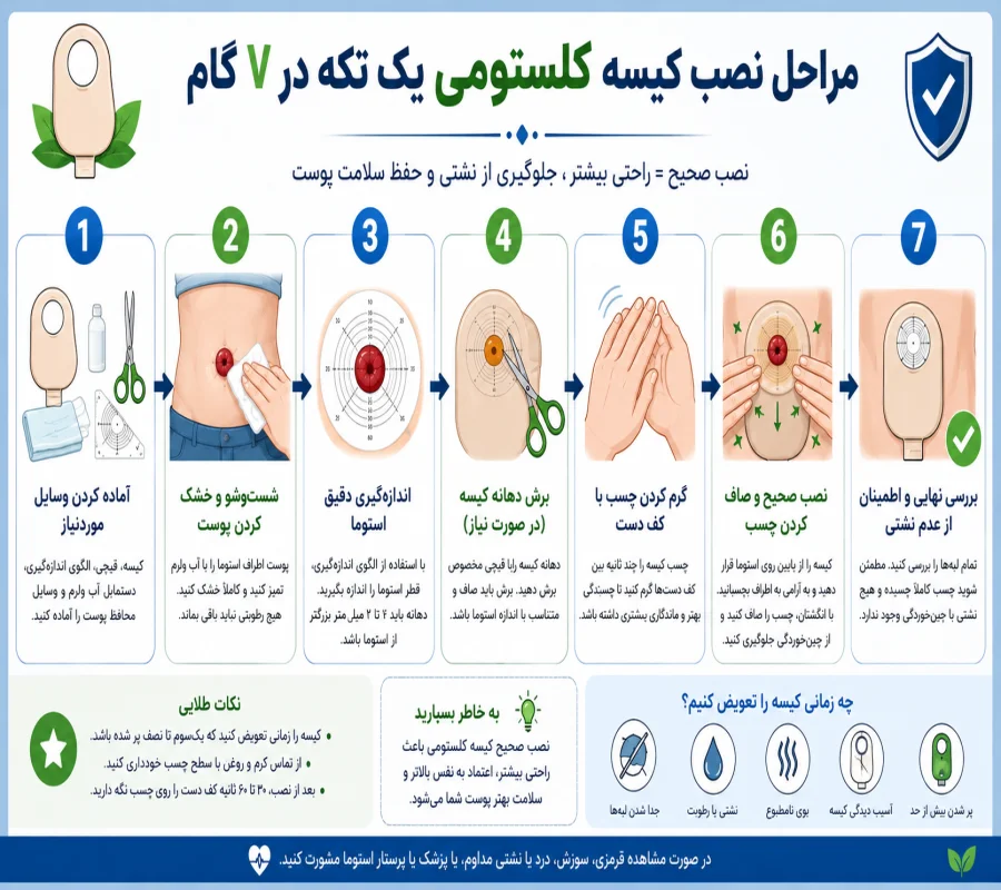 مراحل نصب کیسه کلستومی یک تکه