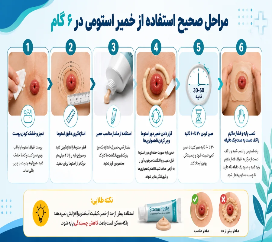 مراحل استفاده از خمیر استومی