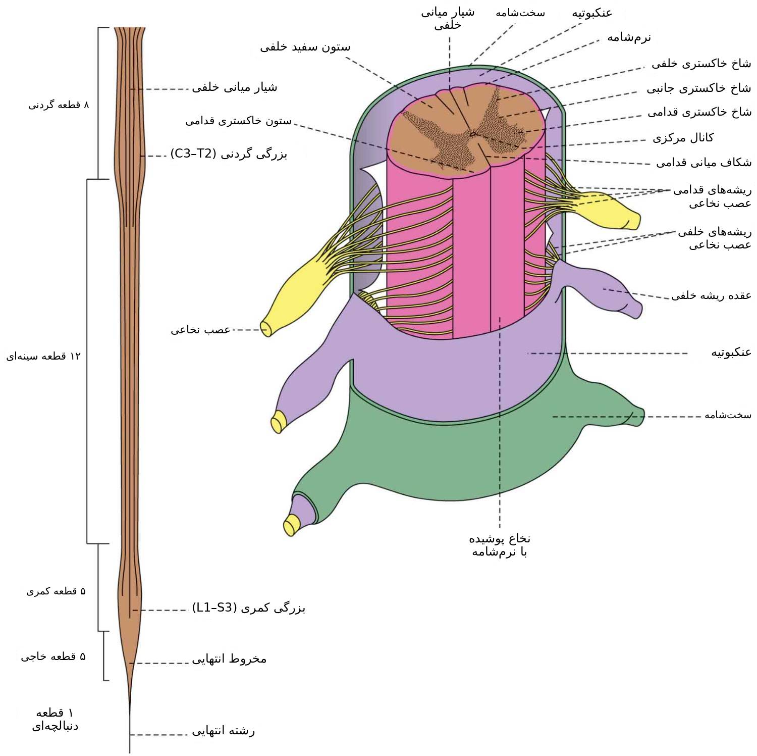 محل ضایعهی سکته در بصل النخاع (مطابق محتوای واقعی تصویر)