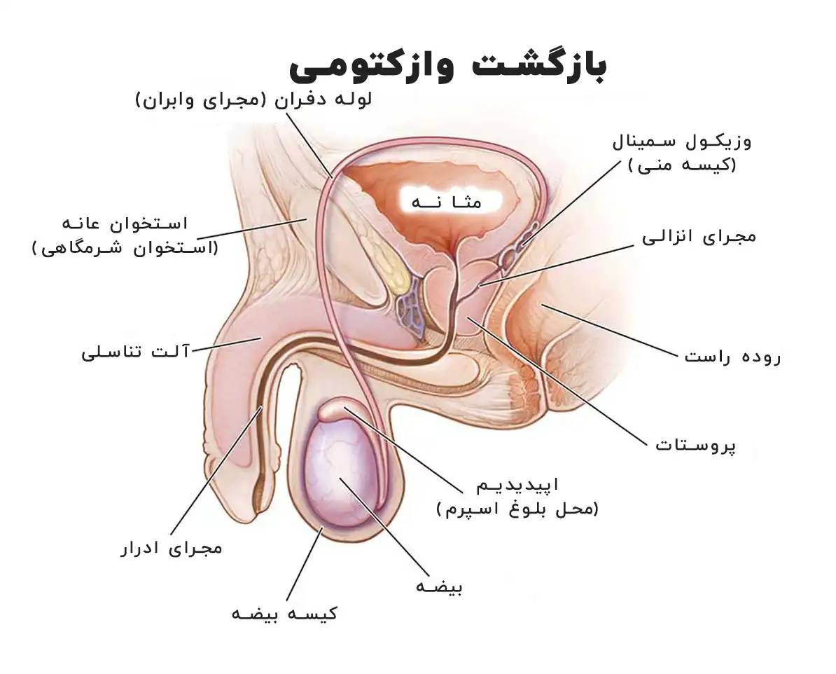 مرد