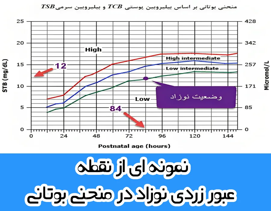 جدول زردی نوزاد