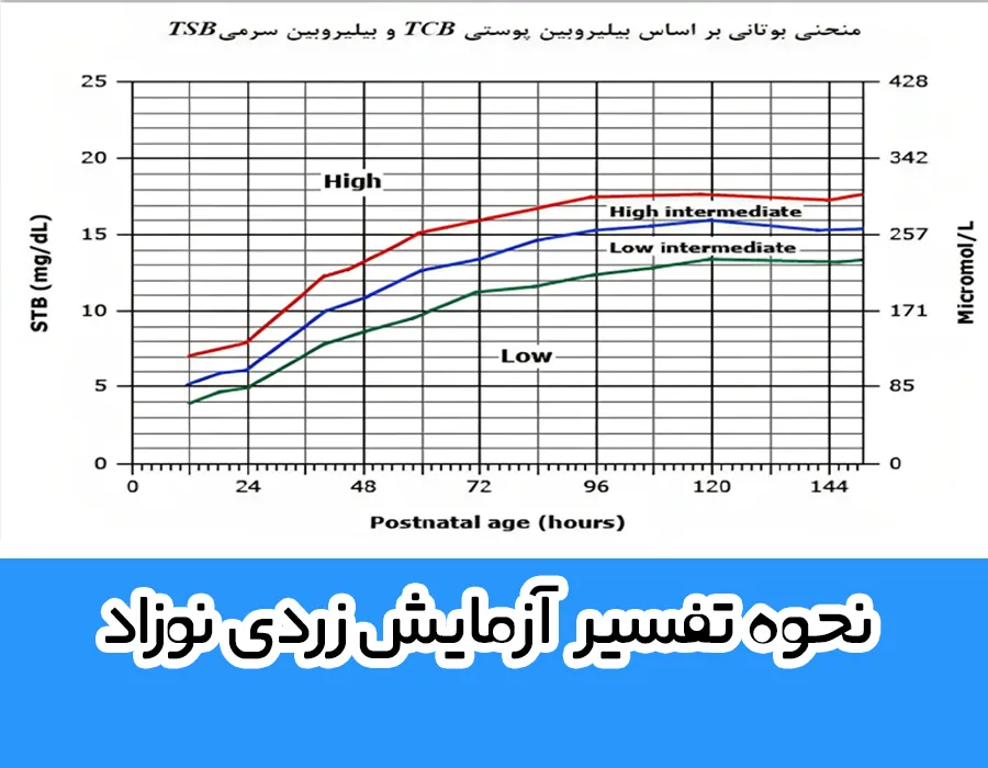 جدول زردی نوزاد