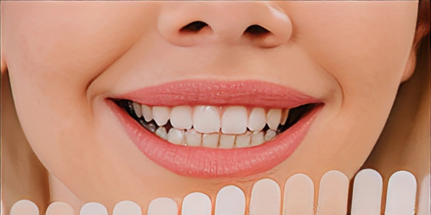 کامپوزیت زنیت خوبه؟