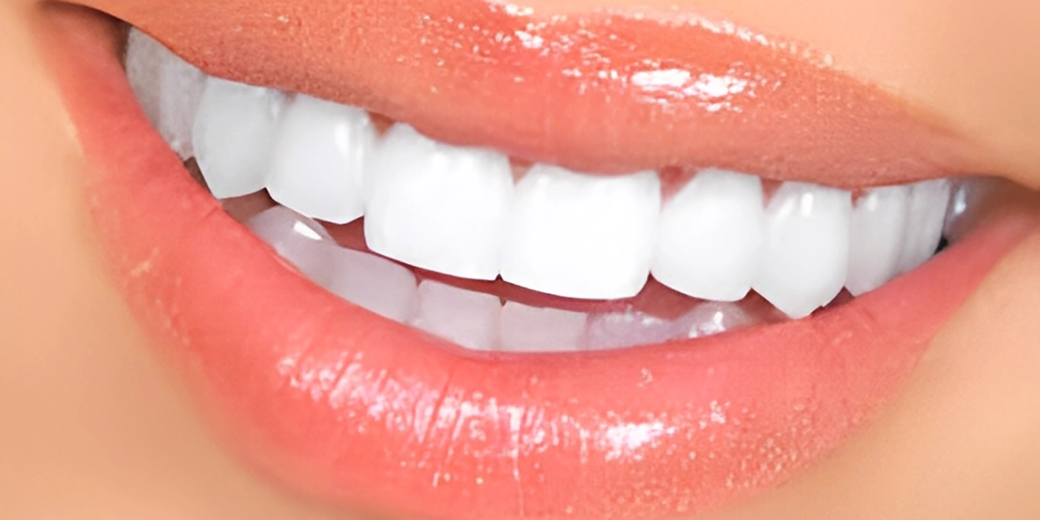 کامپوزیت سارمکو خوبه؟
