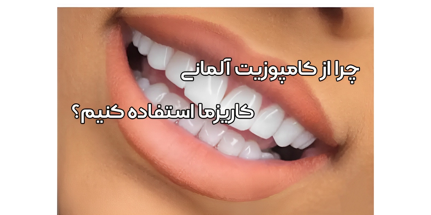 کامپوزیت کاریزما المان خوبه؟