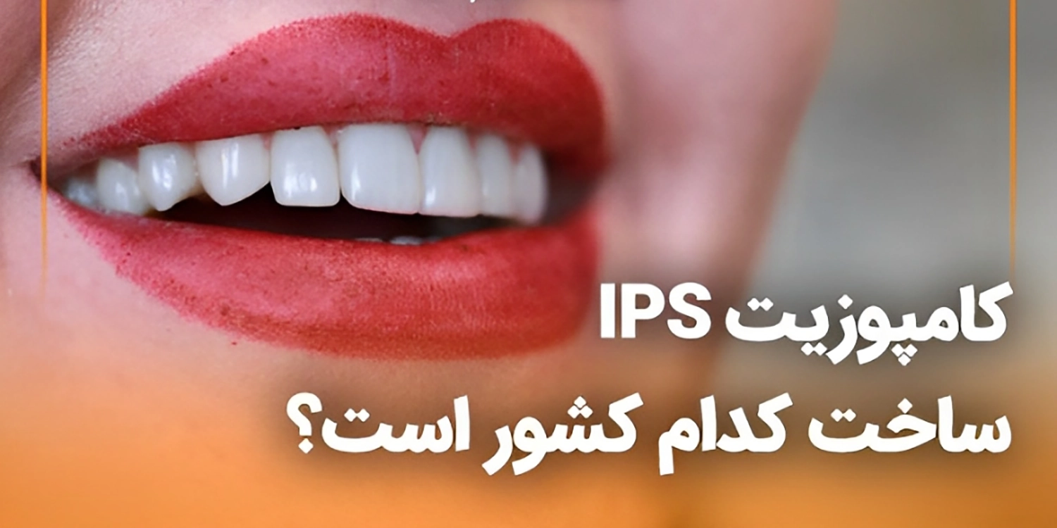 کامپوزیت ips ساخت کدام کشور است