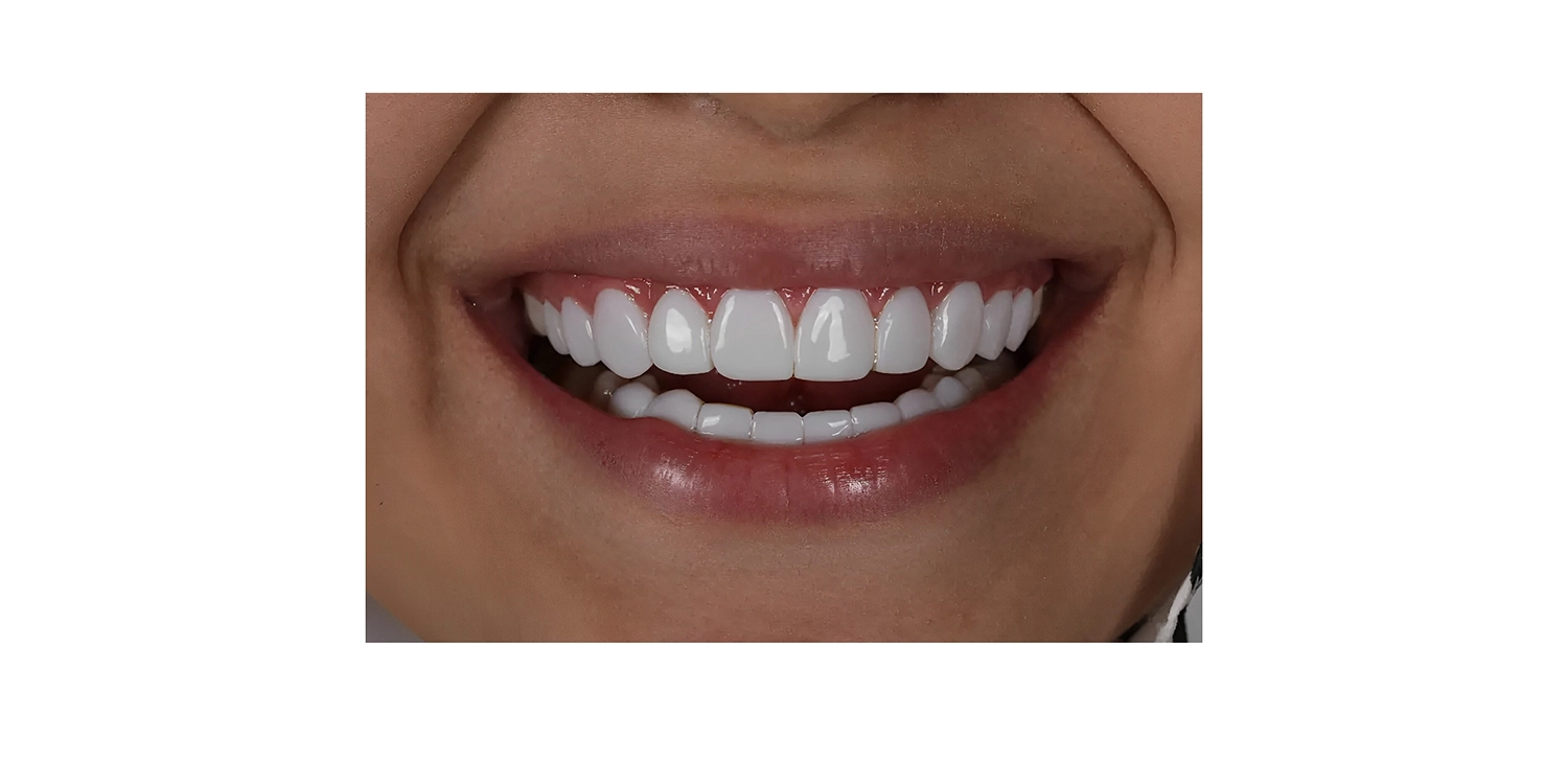 کامپوزیت کاریزما المان خوبه؟