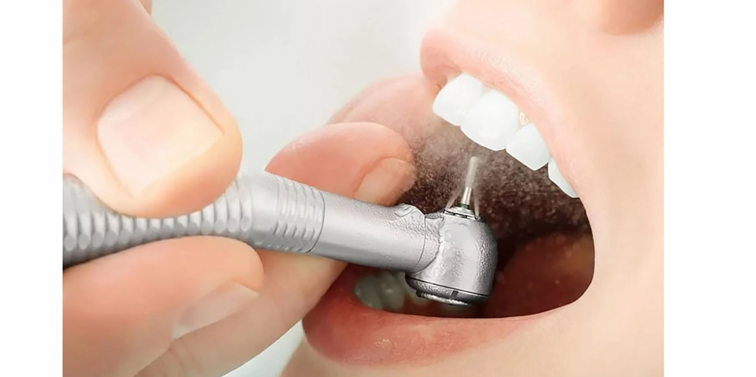 نحوه کار با ایرفلو دندانپزشکی