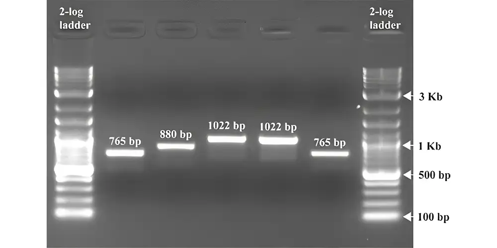 اصول کلی روش الکتروفورز Electrophoresis