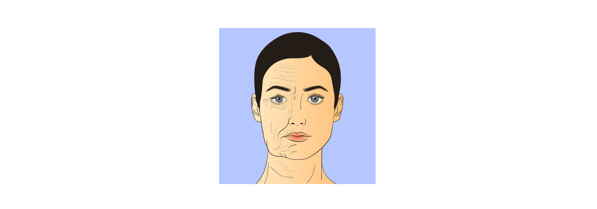کوکتل شبه بوتاکس مزولایک