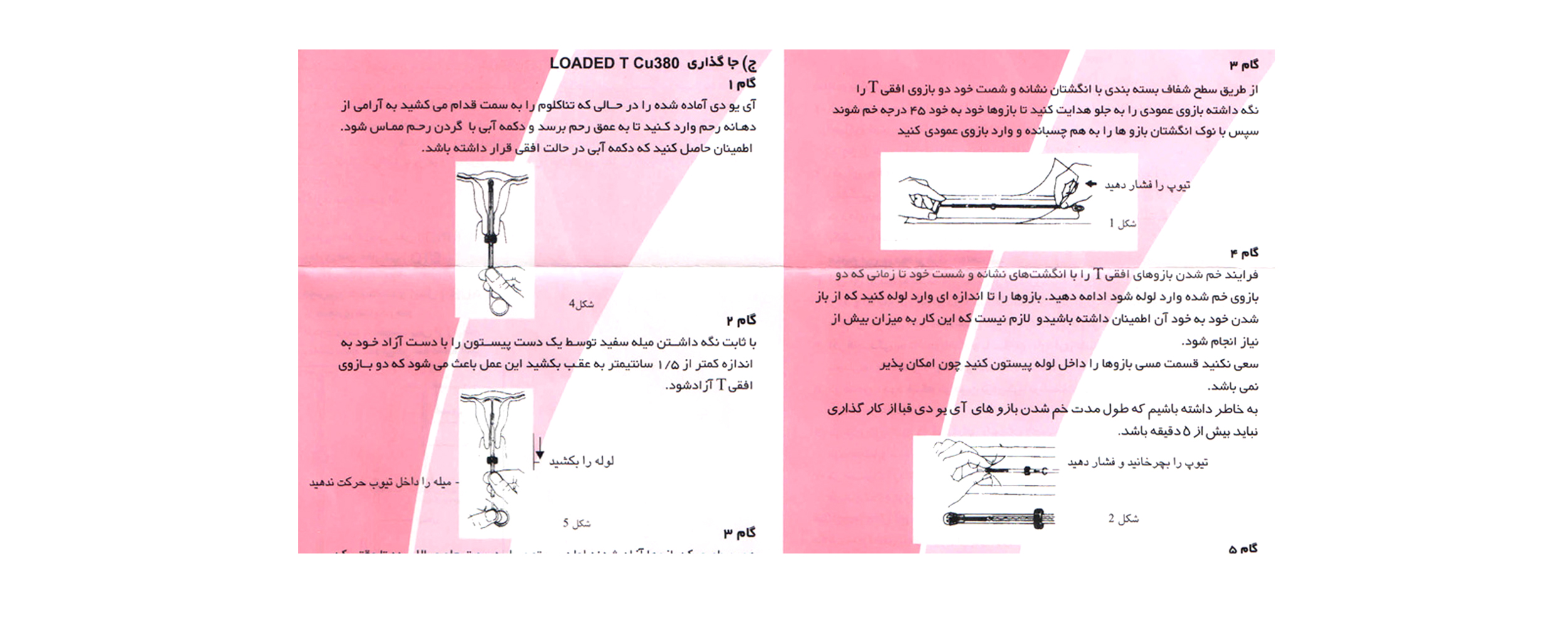 استفاده از آیودی برای جلوگیری از بارداری