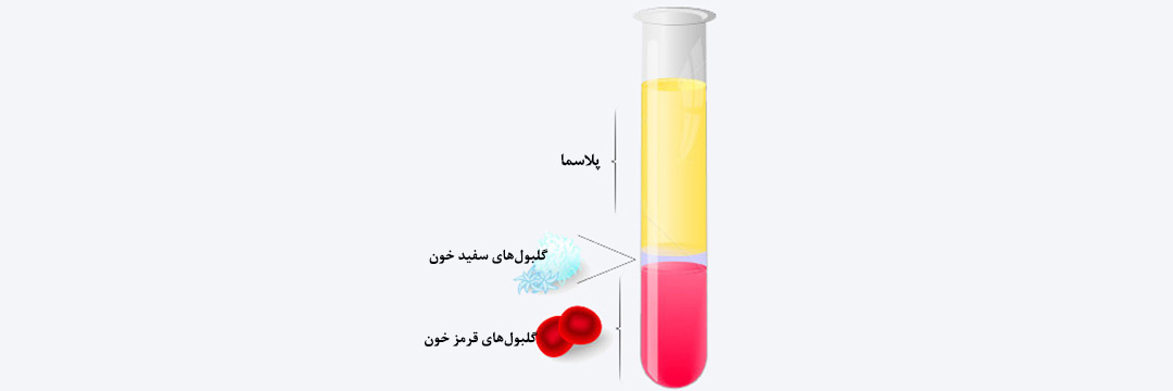 قیمت کیت پی آر پی