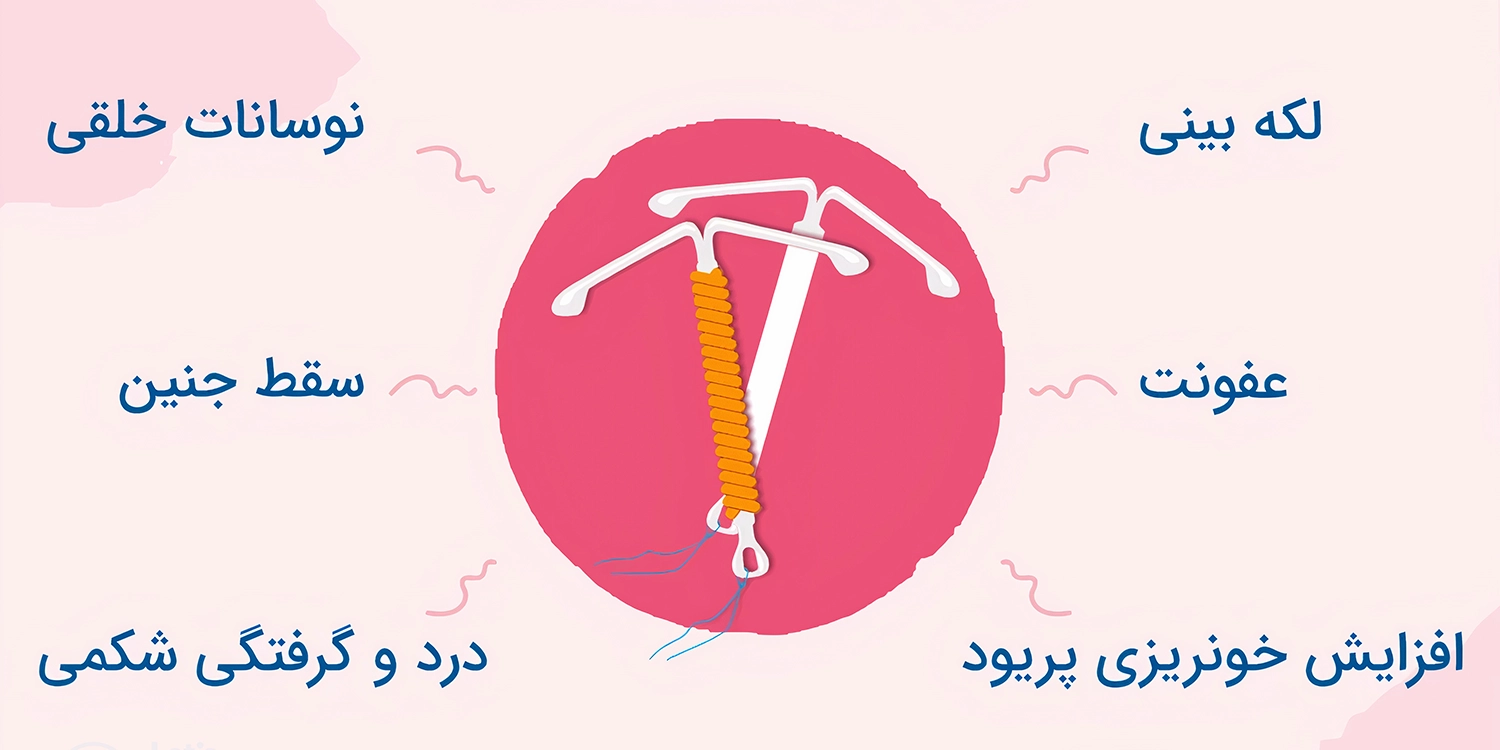 عوارض دستگاه آی یو دی