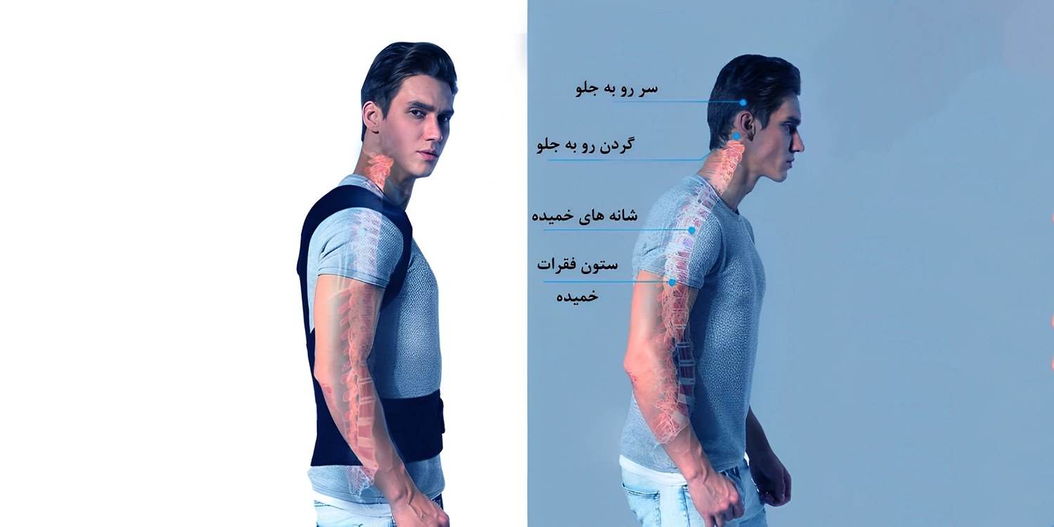 استفاده از قوزبند برای افتادگی شانه