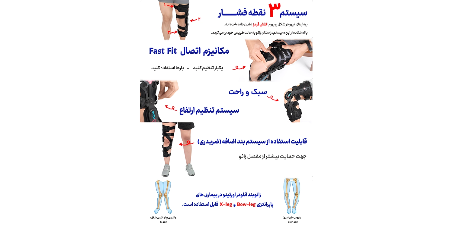 زانوبند طبی برای پای پرانتزی