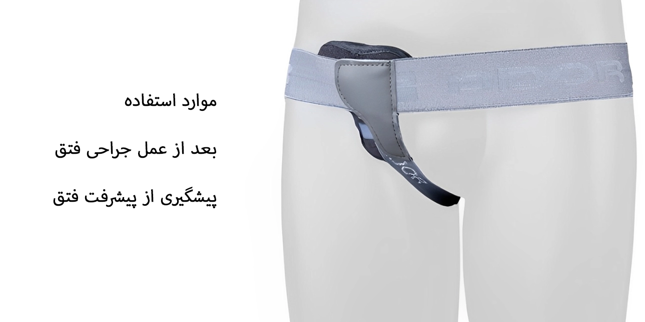 فتق بند آدور