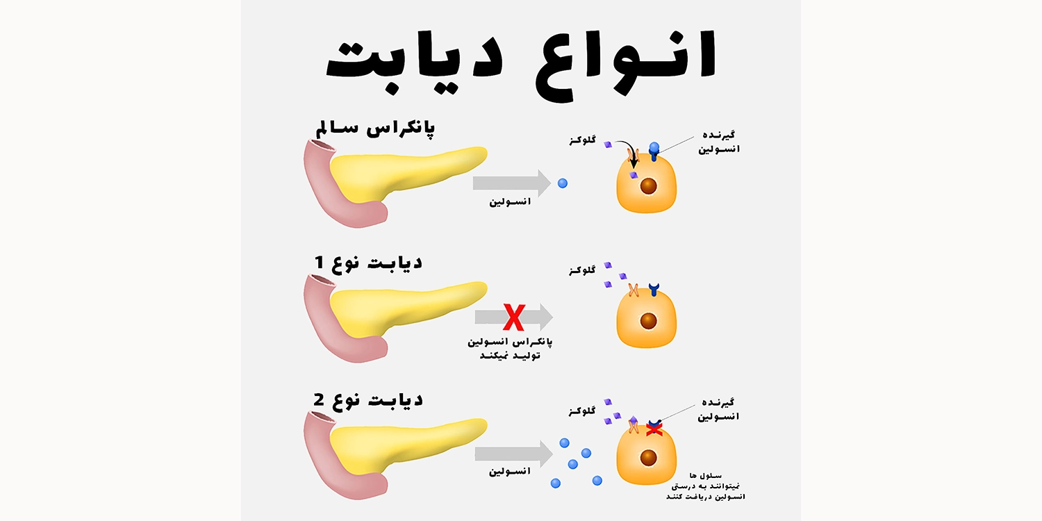 قند خون چند نیاز به انسولین دارد