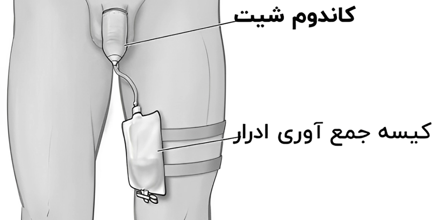 کاندوم شیت چیست