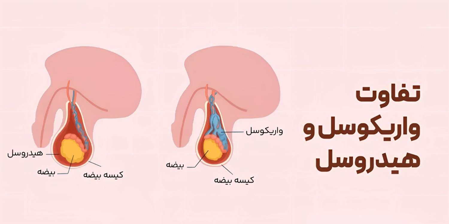 بیضه بند