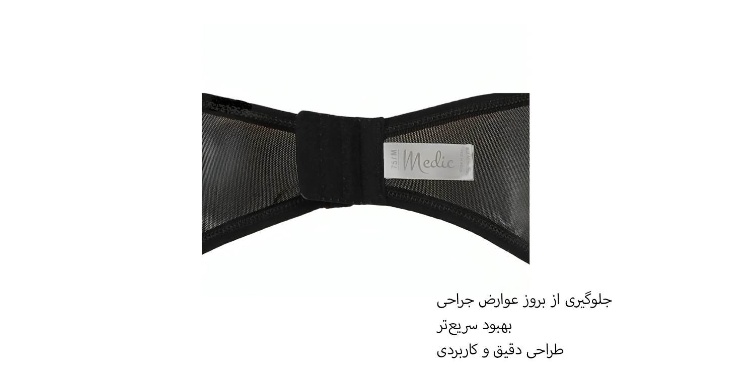 گن بعد از جراحی لیپوماتیک و لیفت بازو مدیک