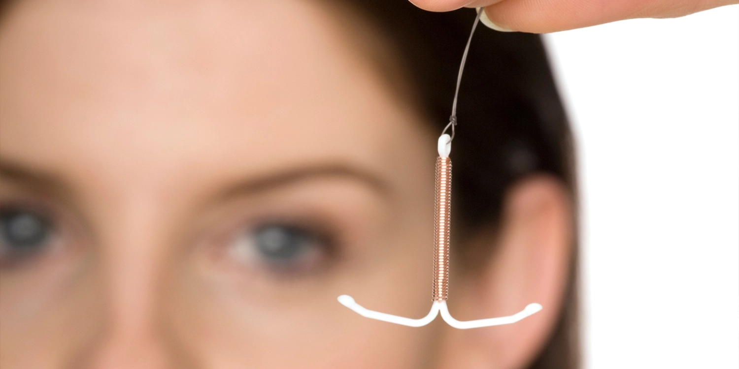 بعد از گذاشتن ای یو دی باید استراحت کرد؟