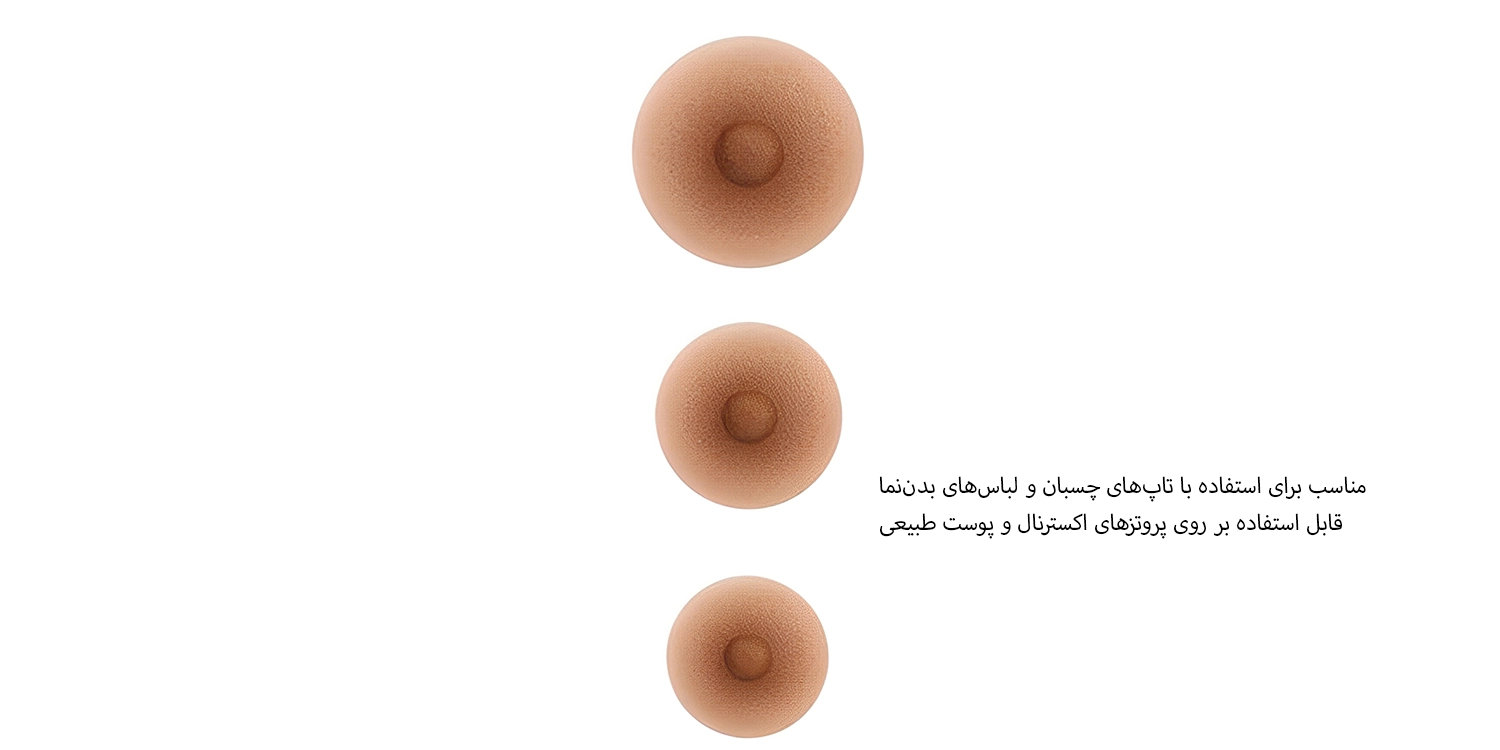 نیپل اکسترنال