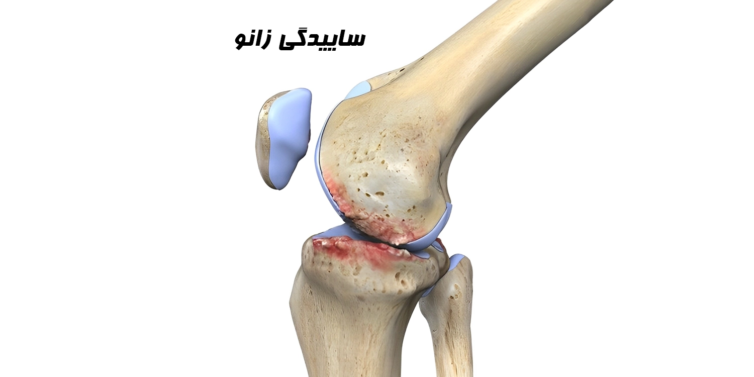 زانوبند مخصوص ساییدگی زانو